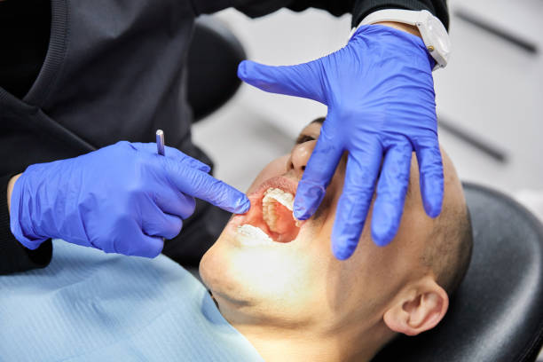Best Emergency Dentist for Lost Fillings or Crowns in University Gardens, NY